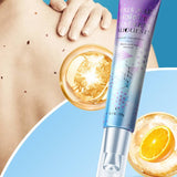 Bedsore Body Moisturizing Cream, Skin Ointment