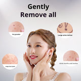 Electric Home Beauty Laser Fleck Removal Pen