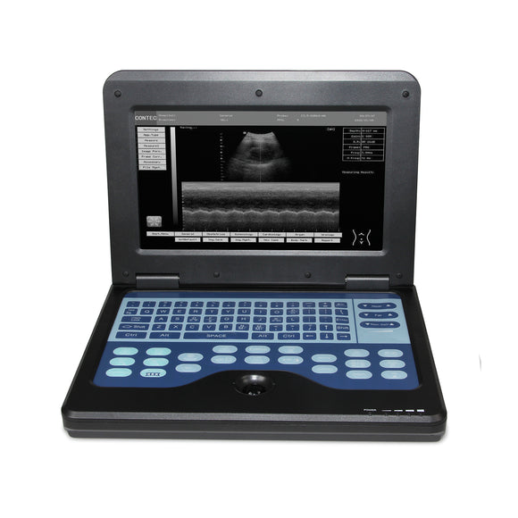 Portable Ultrasound Scanner, 3.5 Convex Probe Laptop, Digital Diagnostic Machine
