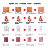 Nursing Vein, Care Cream