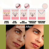 Fade Spot Repair, Dull Skin Whitening, Lightening Cream