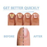 Hand and Foot Nutrition & Moisturizing Repair – Soft, Gentle Cleaning for Bright, Healthy Nails (Pack of 2)