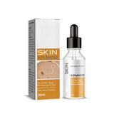 Skin Cleansing Wart Care Cream for External Use