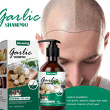 Anti-itching, Anti-dandruff, Hair Shampoo