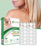 Mole Wart Remover Equipment, Micro Skin Tag Treatment Tool, Easy to Clean Skin Care Device