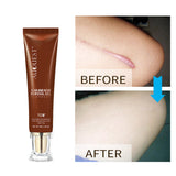 Moisturizing and Repairing Scars, Skin Care Cream
