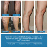 Intravenous Repair Formula, Relieve Pain, Leg Massage, Soreness Maikang Neck Cream (Pack of 2)