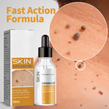 Skin Cleansing Wart Care Cream for External Use