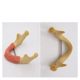 Dental Implant Practice of Model Dental Materials