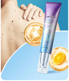 Bedsore Body Moisturizing Cream, Skin Ointment