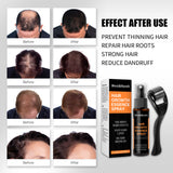Hair Growth Spray, Anti-hair Loss, Nourishing Growth Liquid