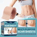 Skin Tone Concealer Patches – Invisible Cover for Scars, Tattoos and Blemishes