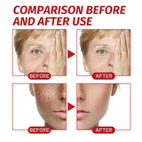 Spot-fading Facial Repair & Whitening Cream