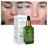 Breylee Acne Treatment Serum, Face Facial Anti Acne Scar Removal Cream, Whitening Skin Repair Pimple Remover Formula