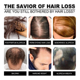 Anti-itching, Anti-dandruff, Hair Shampoo