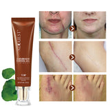 Moisturizing and Repairing Scars, Skin Care Cream