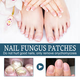Nail Repair – Treats Embedded, Thickened Nails and Restores Brightness