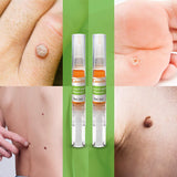 External Wart Care Pen for Common & Flat Warts