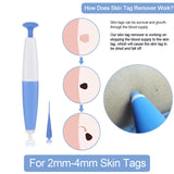 Skin Tag Removal Kit, Home Use Mole Wart Remover, Micro Band Skin Tag Treatment Tool, Easy to Clean Device