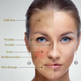 Fade Wrinkles Hydrating and Firming Skin Treatment Oil