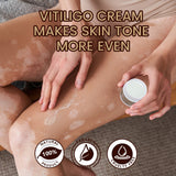 White Spot Care, Antibacterial Cream (Pack of 2)