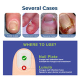 Bright Nail Repair Oil for Thickened Nail Grooves Treatment