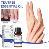Tea Tree Essential Oil, Natural Skin, Scalp & Nail Care Formula