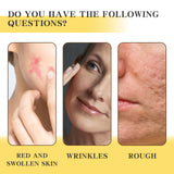 Skin Light Lines Fading, Hydrating, Moisturizing and Nourishing Cream