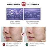 Retinol Tightening, Plastic Activating Cream