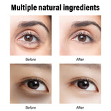 Retinol Skincare, Fade Dark Circles, Fishtail Pattern