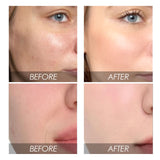 Turmeric Facial Skin Care, Removes Dark Spot, Fade Anti-wrinkle Fine Lines, Moisturizing Skin Color Improvement Formula
