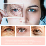 Restoring Eye Cream, Moisturizing Skin Fading, Anti-wrinkle Formula