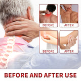 Bee Venom Extract Cream – Relieves Neck, Back, Wrist & Joint
