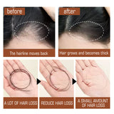 Moisturizing Hair Root Strengthening and Anti-fall, Batana Oil Hair Conditioner