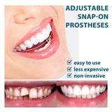 Adjustable Snap-on Dentures, Modified Correction Kit