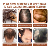 Moisturizing Hair Root Strengthening and Anti-fall, Batana Oil Hair Conditioner