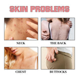 Exfoliating Smallpox Diluting, Bath Soap (Pack of 2)