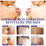 Back Care Spray, Smallpox Diluting Back Acne Cleaning and Repair Formula