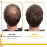 Biotin Dense Hair Series Deep Cleaning Kit