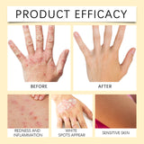 Bee Venom Neck Cream for Skin Repair and Spots Removal (Pack of 2)