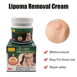 Chinese Herbs, Multiple Anti-tumor Lipoma Pain Cream (Pack of 2)