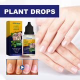 Hand and Foot Soft Nail Thickening Care Solution (Pack of 2)