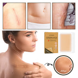 Invisible Skin Tone Concealer Patches – Cover for Tattoos and Scars