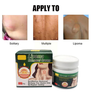 Chinese Herbs, Multiple Anti-tumor Lipoma Pain Cream (Pack of 2)