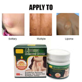 Chinese Herbs, Multiple Anti-tumor Lipoma Pain Cream (Pack of 2)