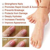 Thickening Nail Repair Serum for Hands and Feet – Improves Onychomycosis