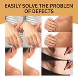 Invisible Skin Tone Concealer Patches – Cover for Tattoos and Scars