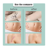 Skin Tone Concealer Patches – Invisible Cover for Scars, Tattoos and Blemishes