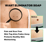 Skin Cleansing Soap for Wart-prone & Spot Areas