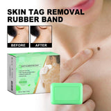 Skin Cleansing Soap for Wart-prone & Spot Areas